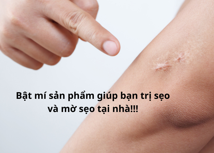 Kem Đặc Trị Sẹo Thâm Klirvin Nga Chính Hãng.Bật mí sản phẩm giúp bạn trị sẹo và mờ sẹo tại nhà!