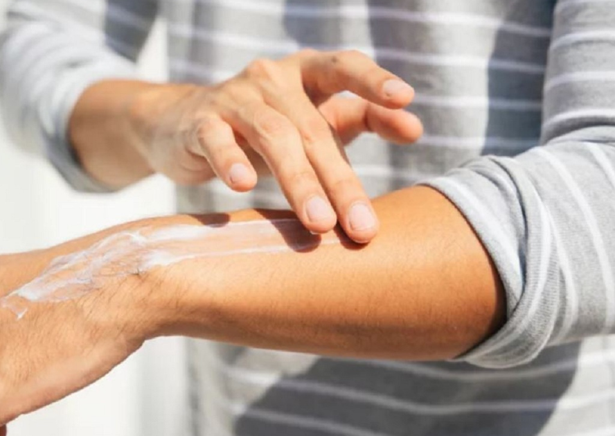 Kem chống nắng một trong những món cần dùng vào mùa hè