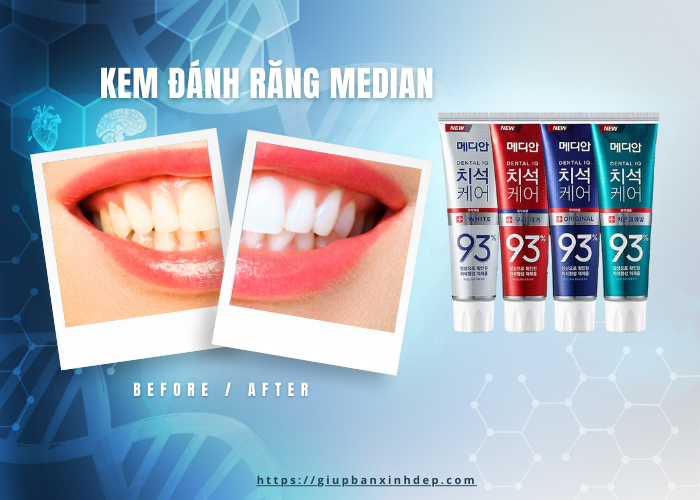 Kem đánh răng Median Nhập khẩu Hàn Quốc- Giúp răng trắng sáng